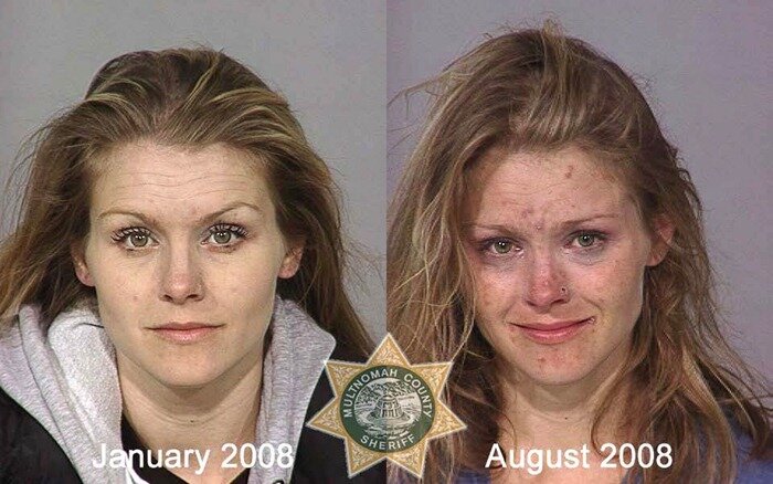 These Before And After Photos Of Drug Users Are Absolutely Horrifying.